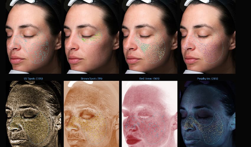 Cuidado de la piel - Farmacia Martel