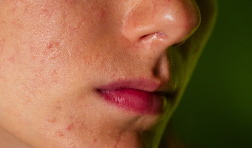 Qué son los puntos rubí