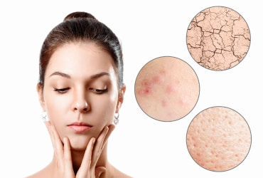 Qué son los puntos rubí