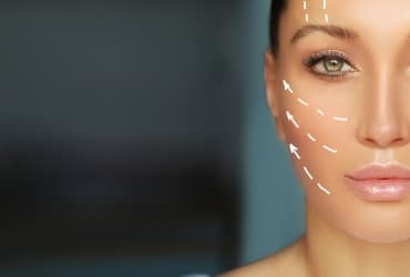 Tratamiento post toxina botulinica