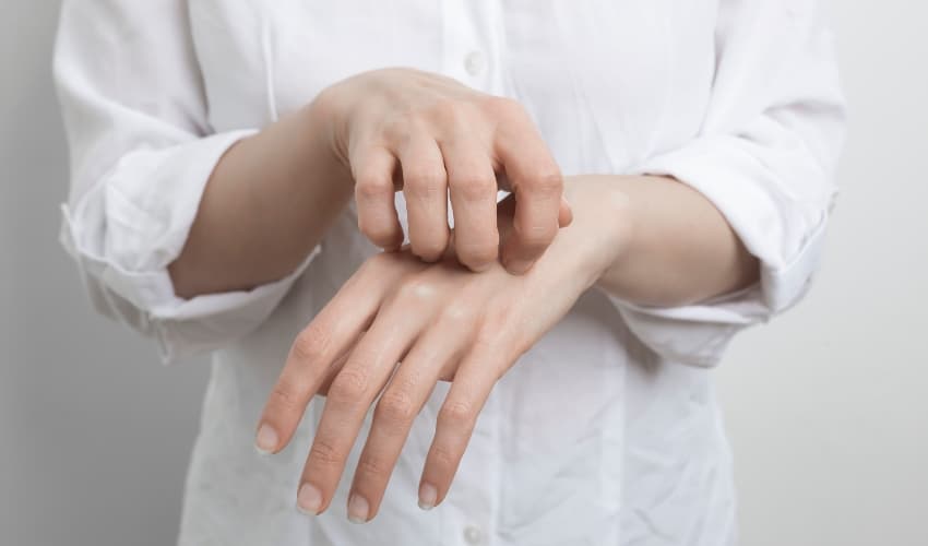 Prevenir y curar la sarna