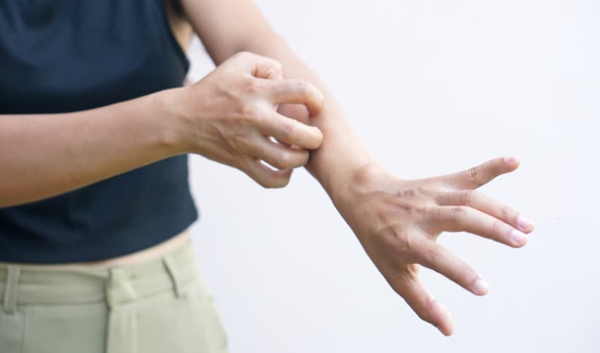 Infecciones en la piel