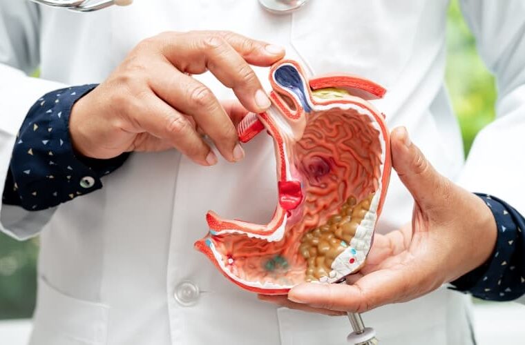 Gripe estomacal - Síntomas y tratamiento