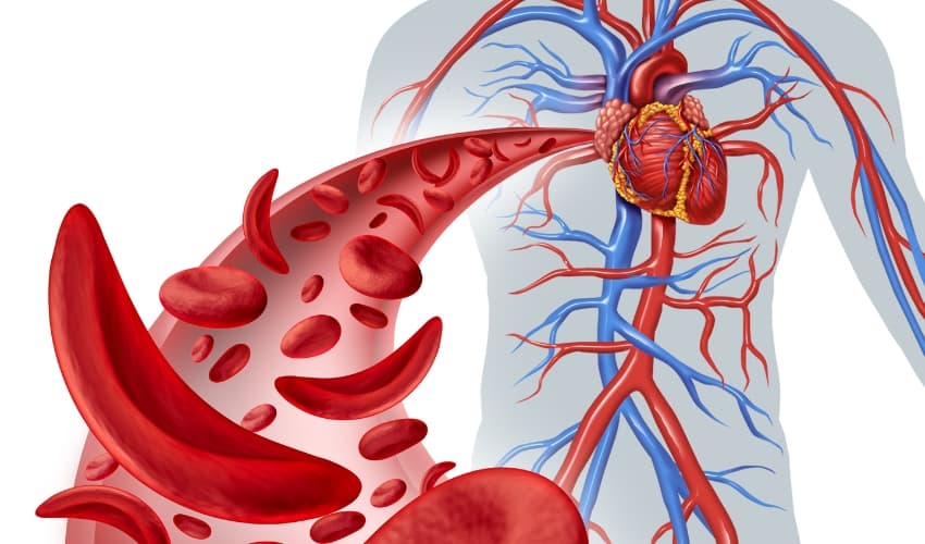 Retención de líquidos y mejorar la circulación