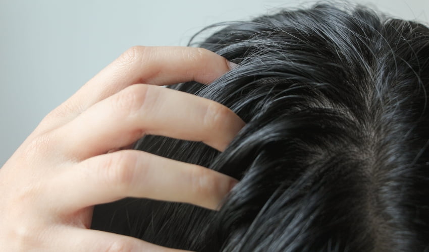 Picor en el cuero cabelludo