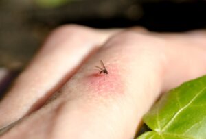Cómo reconocer las picaduras de insectos más comunes